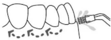 Waterpik Ultra WP112E1 - Plaque Seeker® Tip - 1