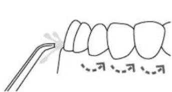 Waterpik WP462E1 - Empfohlene Methode - 1