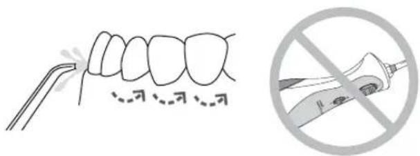 Waterpik WP462E1 - Tecnica consigliata - 1