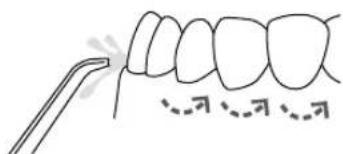 Waterpik WP462E1 - Aanbevolen techniek - 1