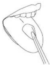 Waterpik WP462E1 - Orthodontische tip - 3
