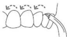 Waterpik WP462E1 - Orthodontic-Düse - 2