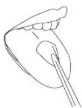 Waterpik WP462E1 - Orthodontic Tip - 3