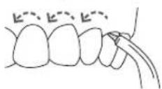 Waterpik WP462E1 - Beccuccio ortodontico - 2