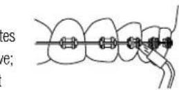 Waterpik WP462E1 - Embout Brosse à dents - 1