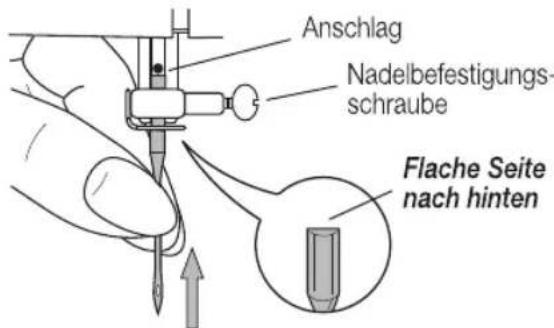 MIO STAR M22 En Vogue - Nadel einsetzen - 1