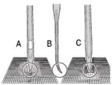 MIO STAR M22 En Vogue - Fehlerhafte Nadeln - 2