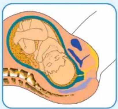 Epi-no Delphine Plus - EPI·NO-Birth Preparation - 1