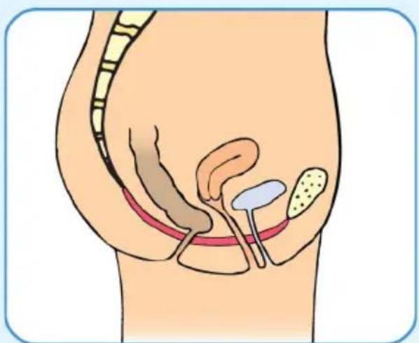 Epi-no Delphine Plus - Programma di Addestramento dei Muscoli del Pavimento Pelvico dopo il Parto - 1