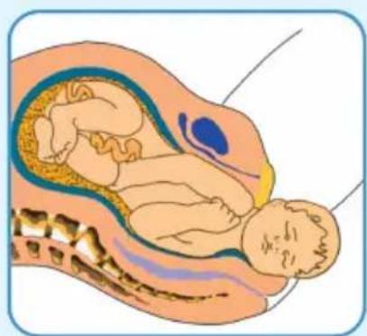 Epi-no Delphine Plus - EPI·NO-Birth Preparation - 3