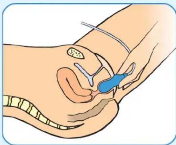 Epi-no Delphine Plus - Comenzando - 1