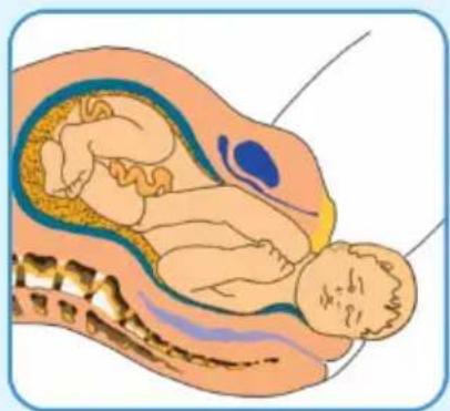 Epi-no Delphine Plus - Aviso / Precauciones - 3