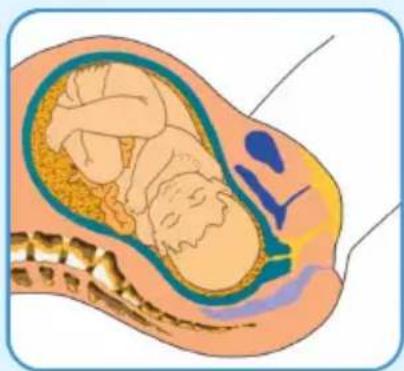 Epi-no Delphine Plus - Wichtige Hinweise - 1