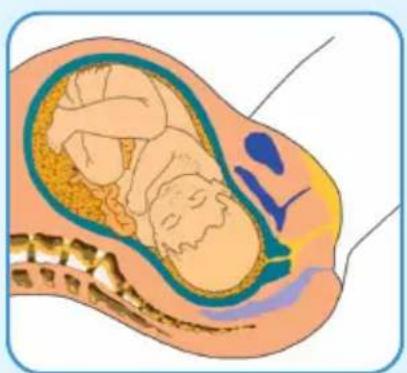 Epi-no Delphine Plus - Précautions - 1