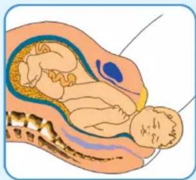 Epi-no Delphine Plus - Wichtige Hinweise - 3