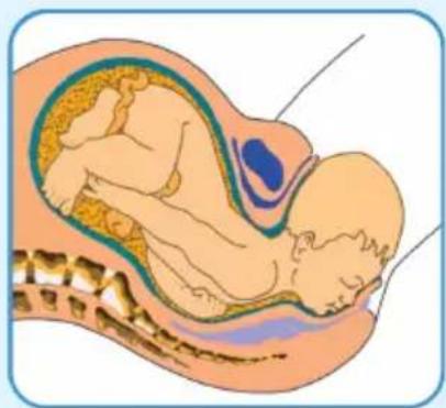 Epi-no Delphine Plus - Wichtige Hinweise - 2