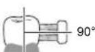 PANASONIC EWDL75 - Front surface and the biting surface of teeth - 1
