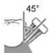 PANASONIC EWDL75 - For the boundary between the teeth and gums - 1