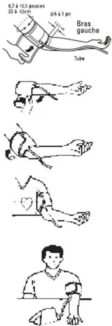 Be.Better RX802 - Mise en place du brassard - 1