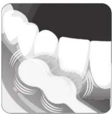 Edel White Sonic Generation - Utilisation desonic generation® - 2