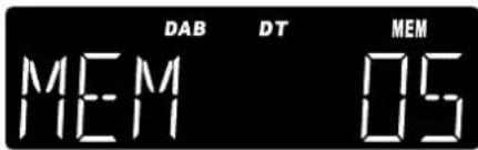 Soundmaster UR2040 - Listen the radio DAB - 2