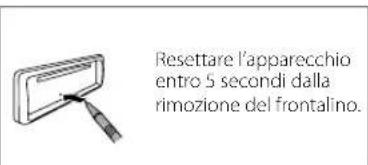 KENWOOD KDCBT730DAB - Frontalino - 3