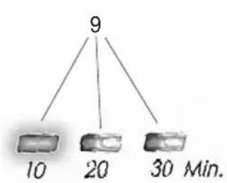 BEURER TL55 - Näyttö - 1