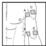 SANITAS SEM 43 - Distance entre les electrodes - 1