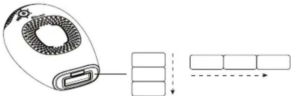 SILKN Infinity H3101 - Metoda z impulzi in metoda z glajenjem - 1
