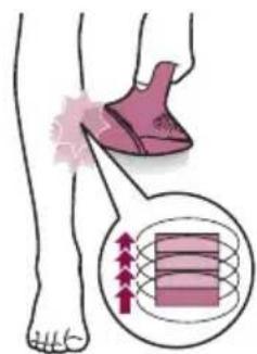 PHILIPS Lumea Prestige BRI947 - Dos发展模式 de tratamiento: "Paso y pulso" y "deslizamente y pulso" - 2