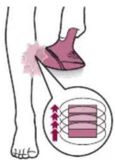 PHILIPS Lumea Prestige BRI947 - C Treatment - 6