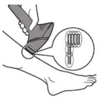 PHILIPS Lumea Prestige BG9041 - Handhabung des Geräts - 5
