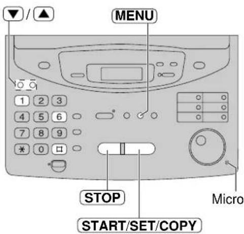 PANASONIC KXFP300BL - Remarque: - 1