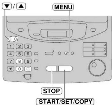 PANASONIC KXFP300BL - Réinitialisation des fonctions élaborées - 2