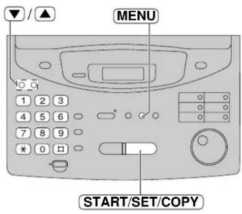 PANASONIC KXFP300BL - Important: - 2