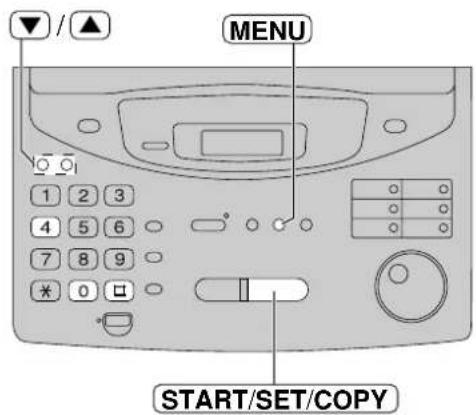 PANASONIC KXFP300BL - Impression du rapport d'envoi pour confirmation - 1