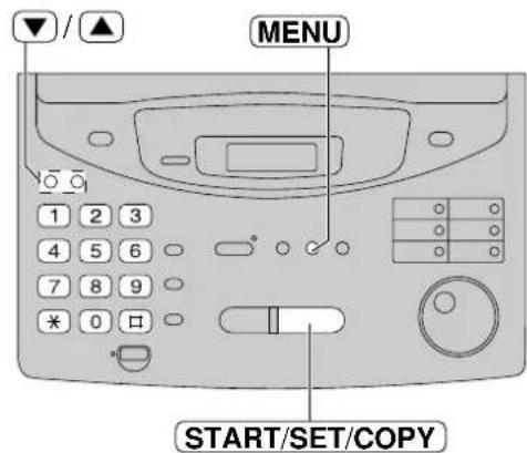 PANASONIC KXFP300BL - Important: - 3