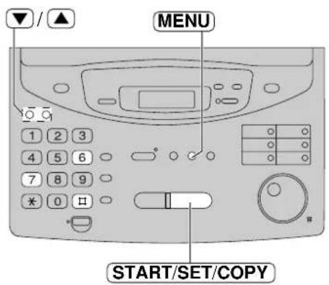 PANASONIC KXFP300BL - Surveillance des messages entrants - 2