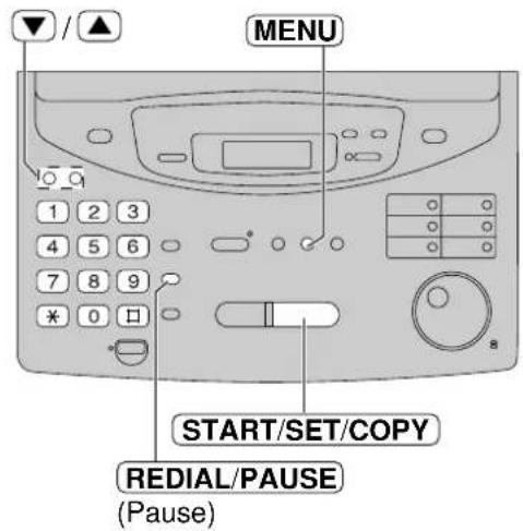 PANASONIC KXFP300BL - Réglage du transfert des messages/appel du récepteur d'appels - 2