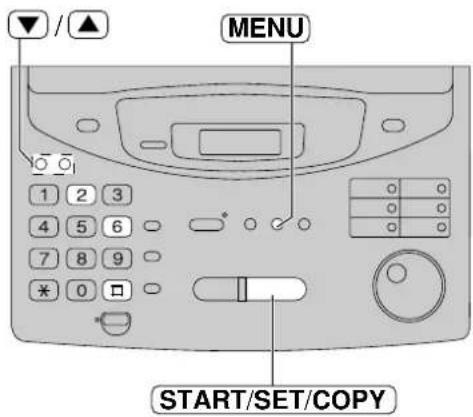 PANASONIC KXFP300BL - Important: - 1