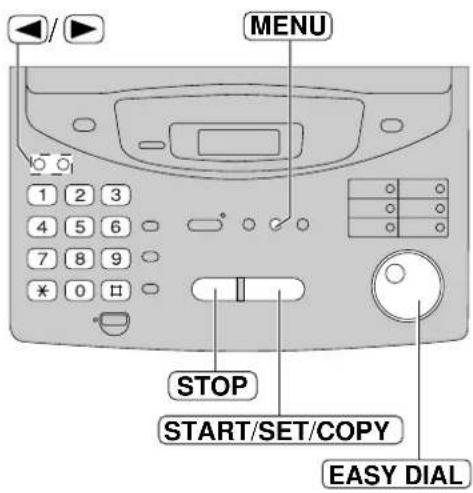 PANASONIC KXFP300BL - Remarques: - 1