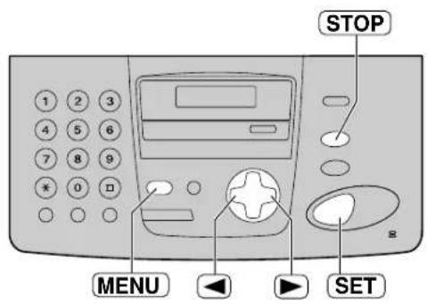 PANASONIC KXFP155BF - Listes et rapport - 1
