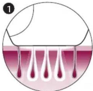 PHILIPS Lumea Advanced SC1998 - How IPL works - 1