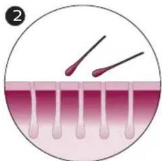 PHILIPS Lumea Advanced SC1998 - How IPL works - 2