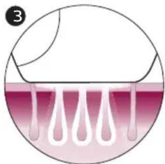 PHILIPS Lumea Advanced SC1998 - How IPL works - 3