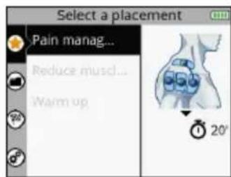 COMPEX SP 8.0 - SELECTIONDEL POSIZIÑAMENTO DEGLI ELETTRODI - 1
