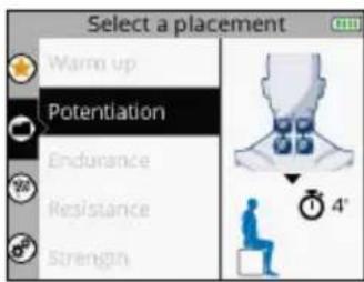 COMPEX SP 8.0 - SELECT ELECTRODE PLACEMENT - 1