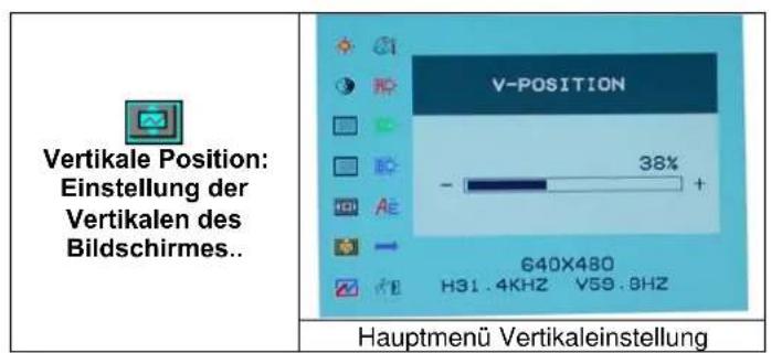 DGM L1523 - Optionswahl - 6