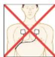 REVITIVE Medic Plus - SCHRITT 5: VERWENDUNG DER ELEKTRODEN-PADS - 4