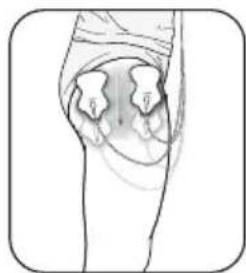 OMRON E3 Intense - JAMBE (HANCHE et CUISSE) - 1